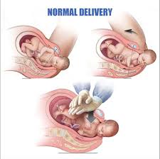 Best Gynaecologist for Normal Delivery in Gachibowli