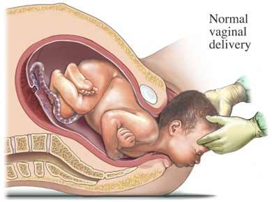 Best Specialist for VBAC Normal Delivery in Madhapur and Gachibowli