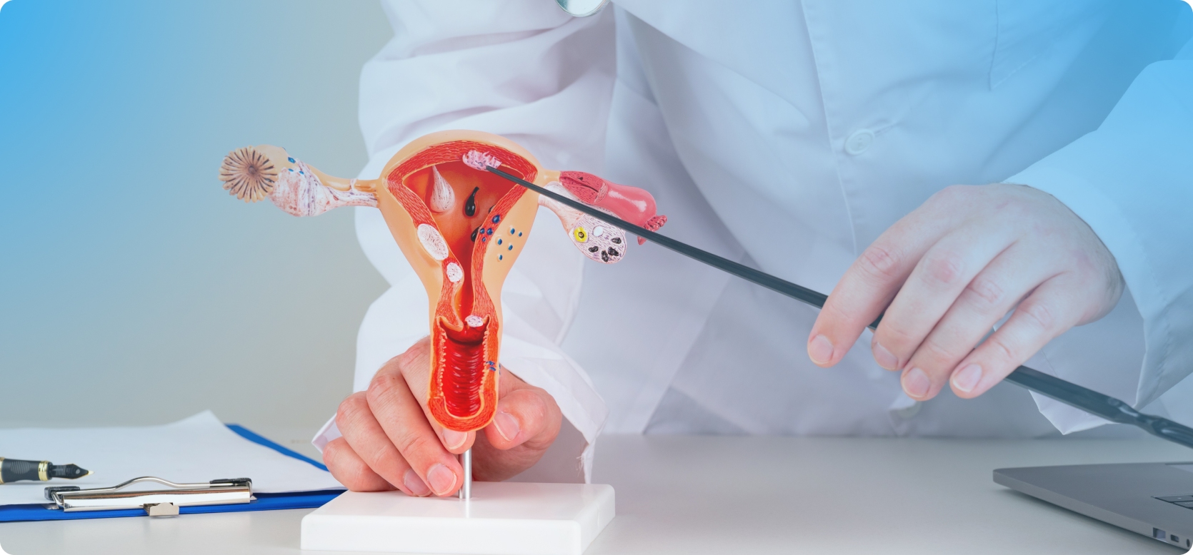 Best Gynaecologist for Ovarian Cyst Removal in Gachibowli – Expert Care by Dr. Nikitha Reddy DS