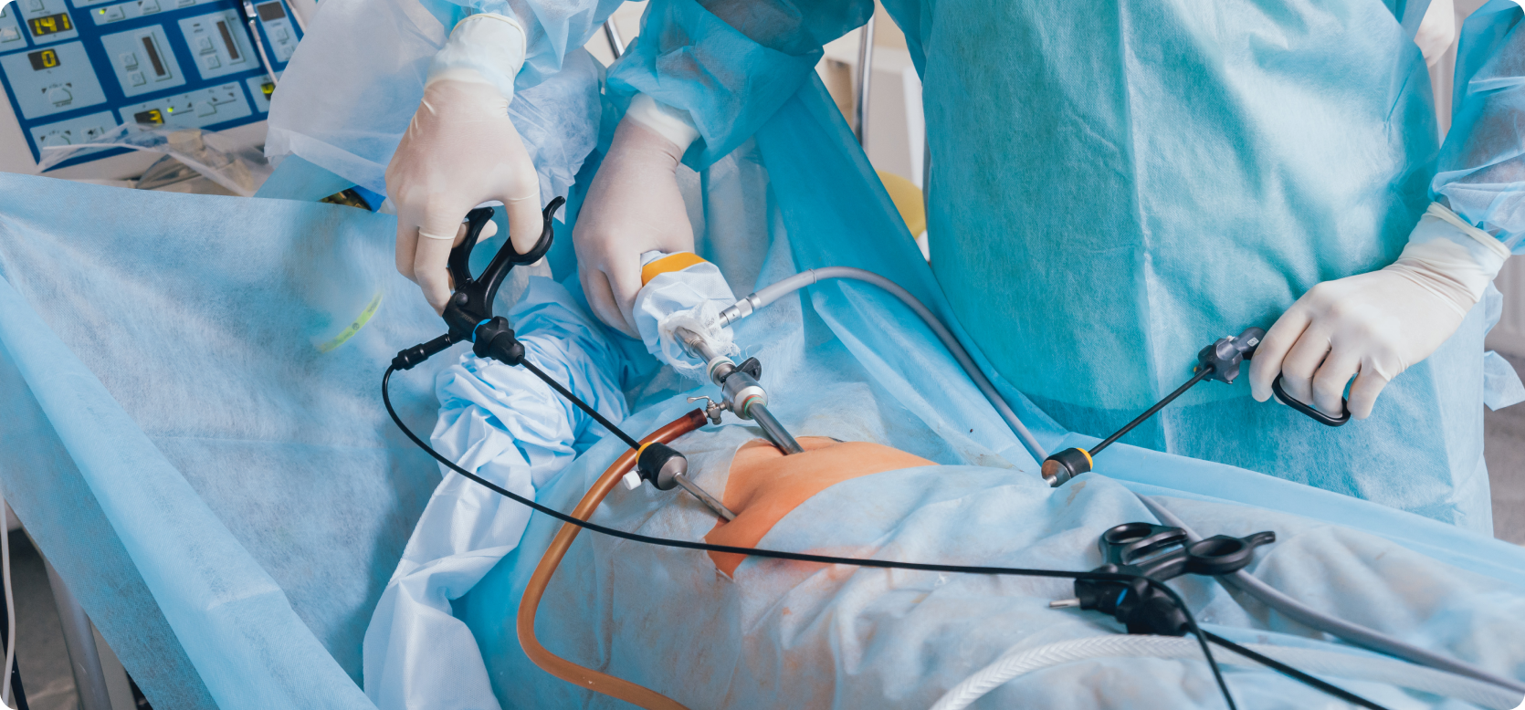 Laparoscopy Surgery for Fibroids in Gachibowli: Benefits & Recovery