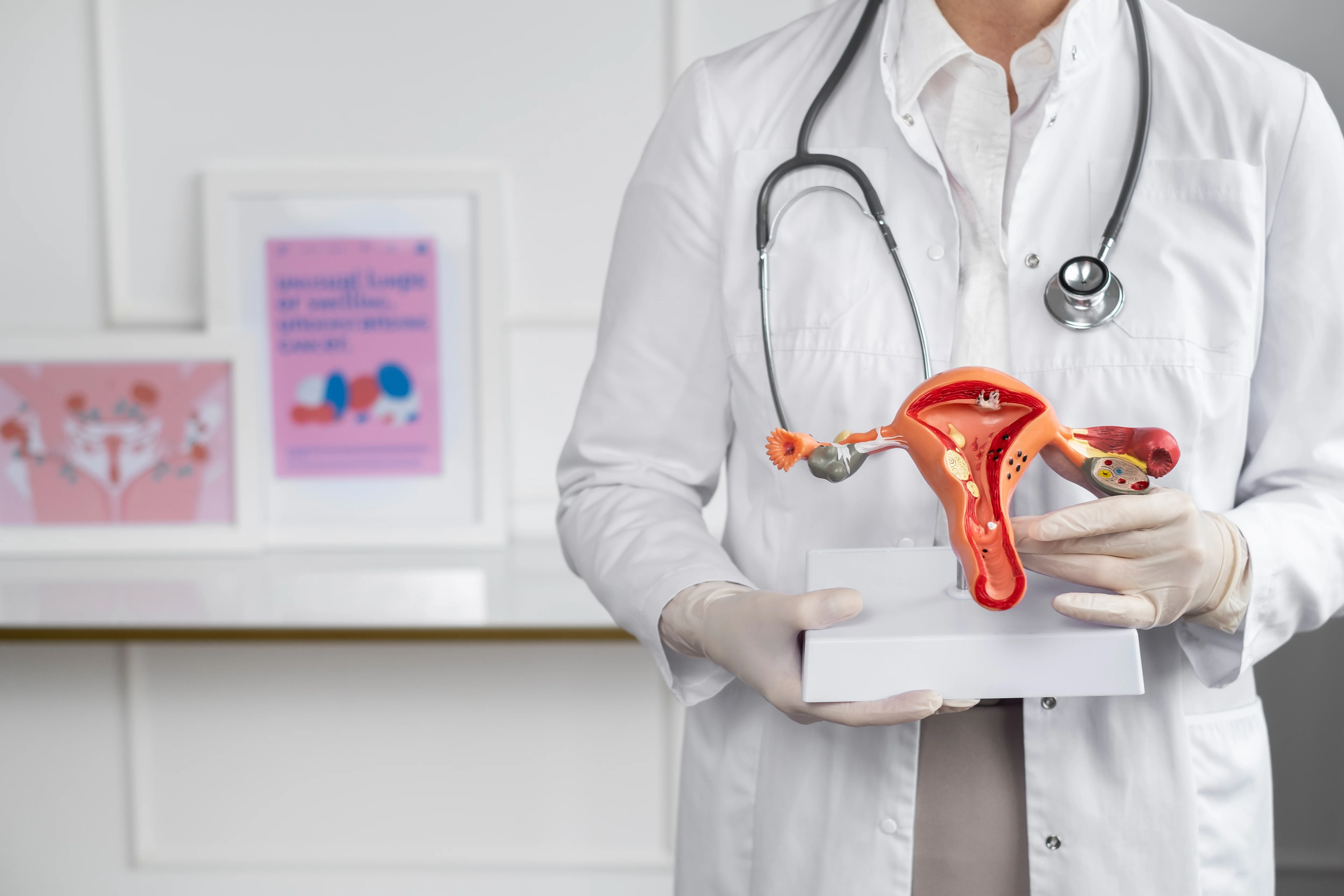Endometriosis